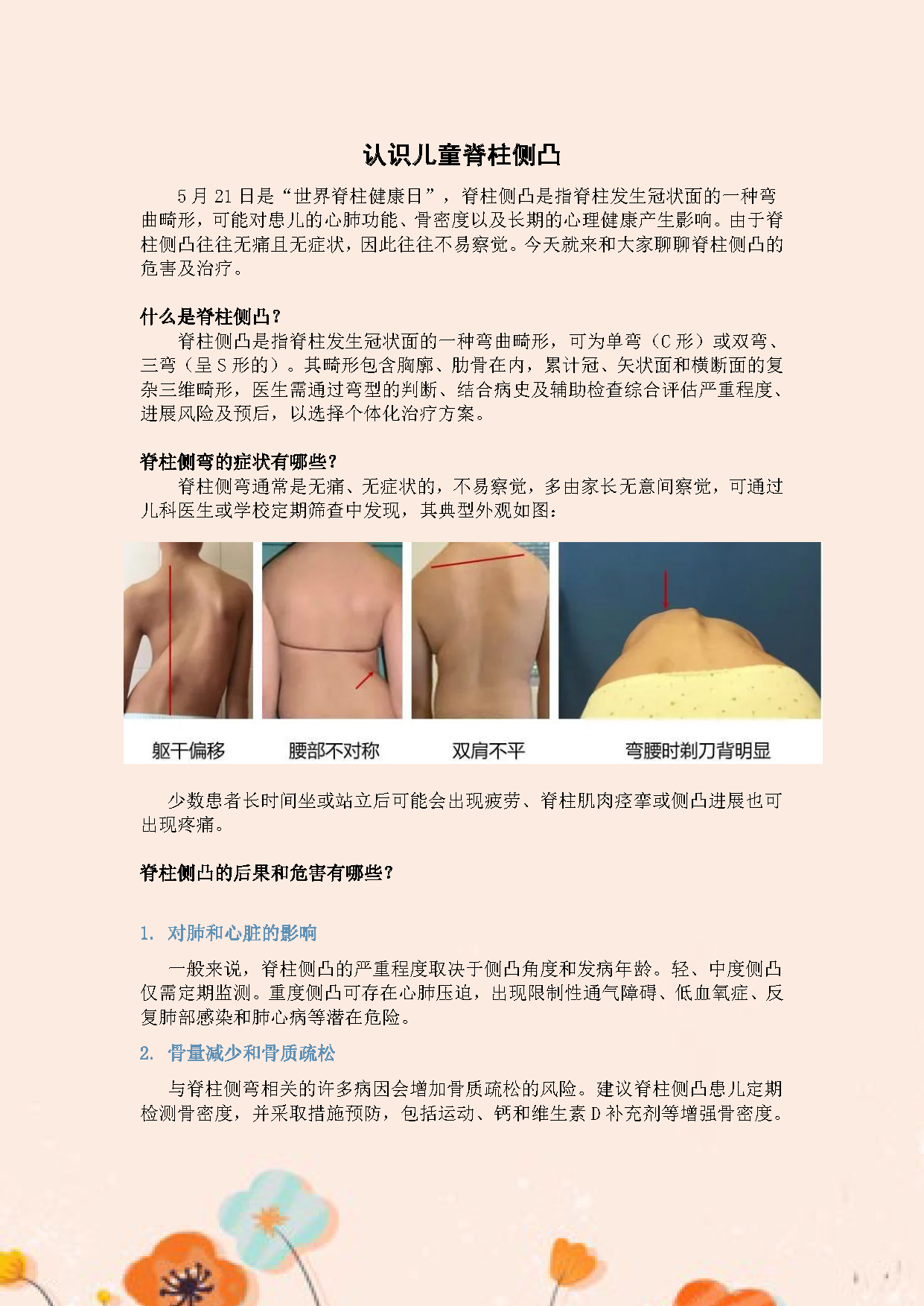 √2025.5认识儿童脊柱侧凸_页面_1.png